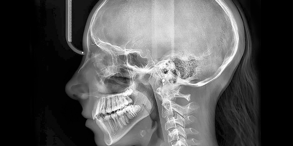 teleradiografia cranio